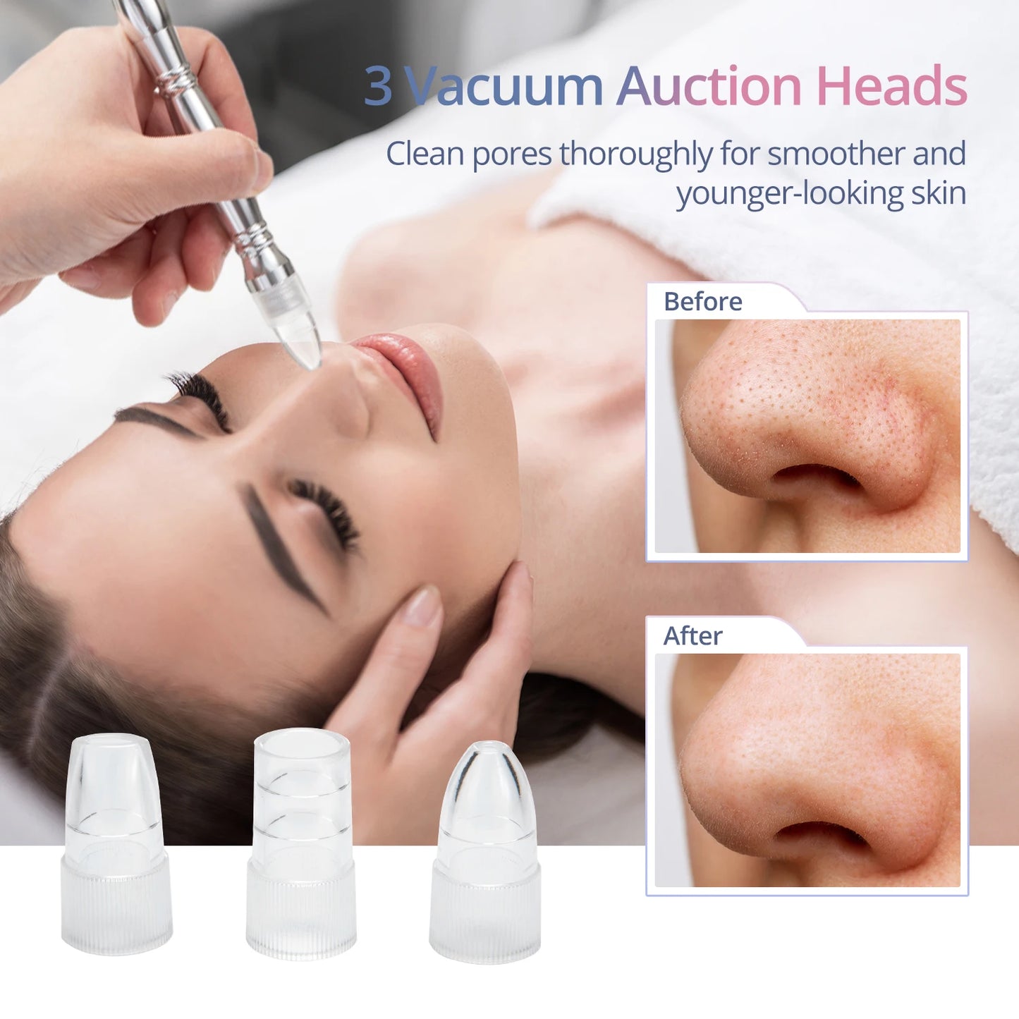 Diamond Microdermabrasion 3-in-1 Machine – Home Facial Cleaning & Nano Spray