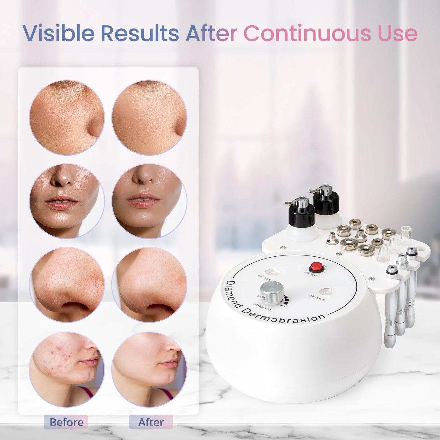 Diamond Microdermabrasion 3-in-1 Machine – Home Facial Cleaning & Nano Spray
